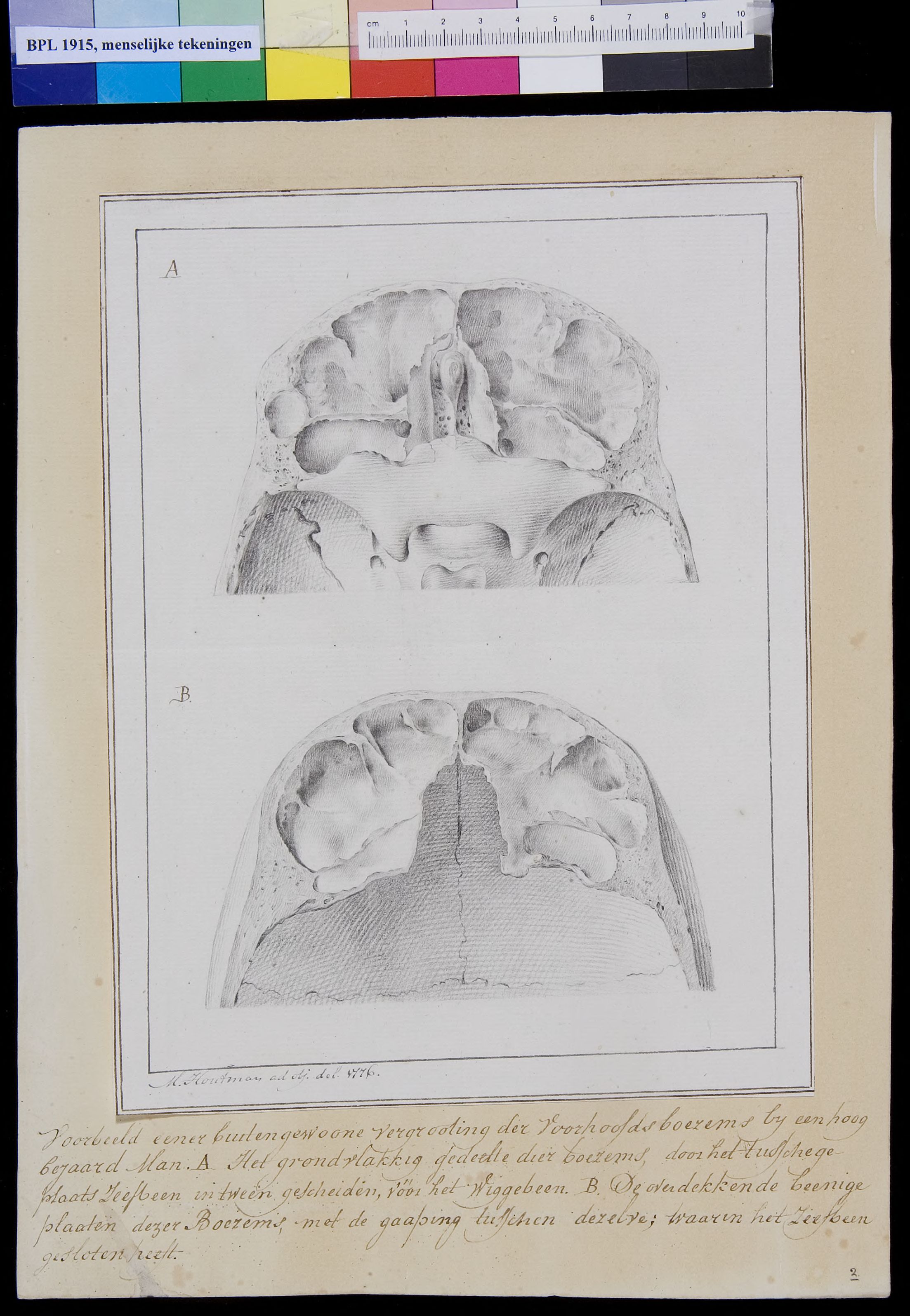 Skull