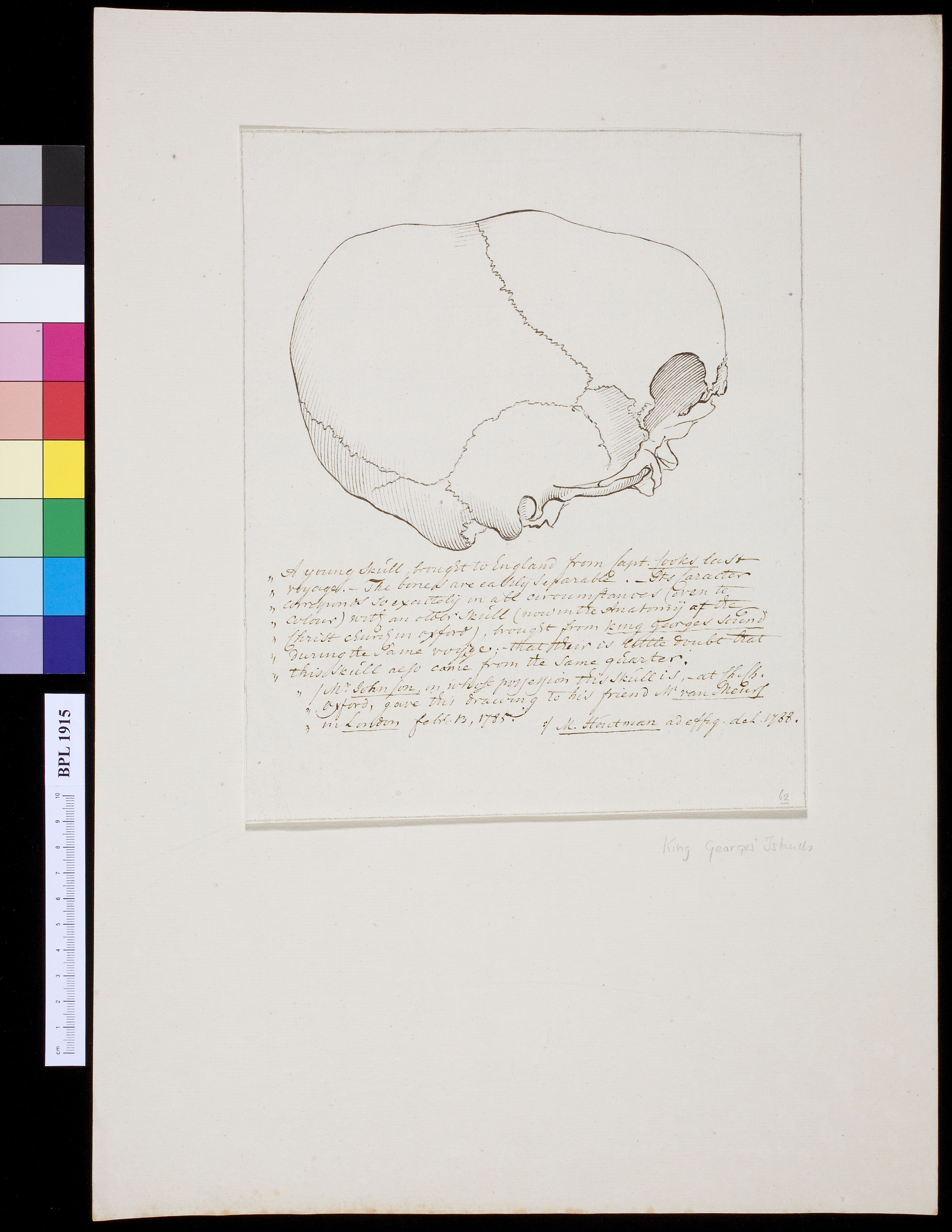 Skull