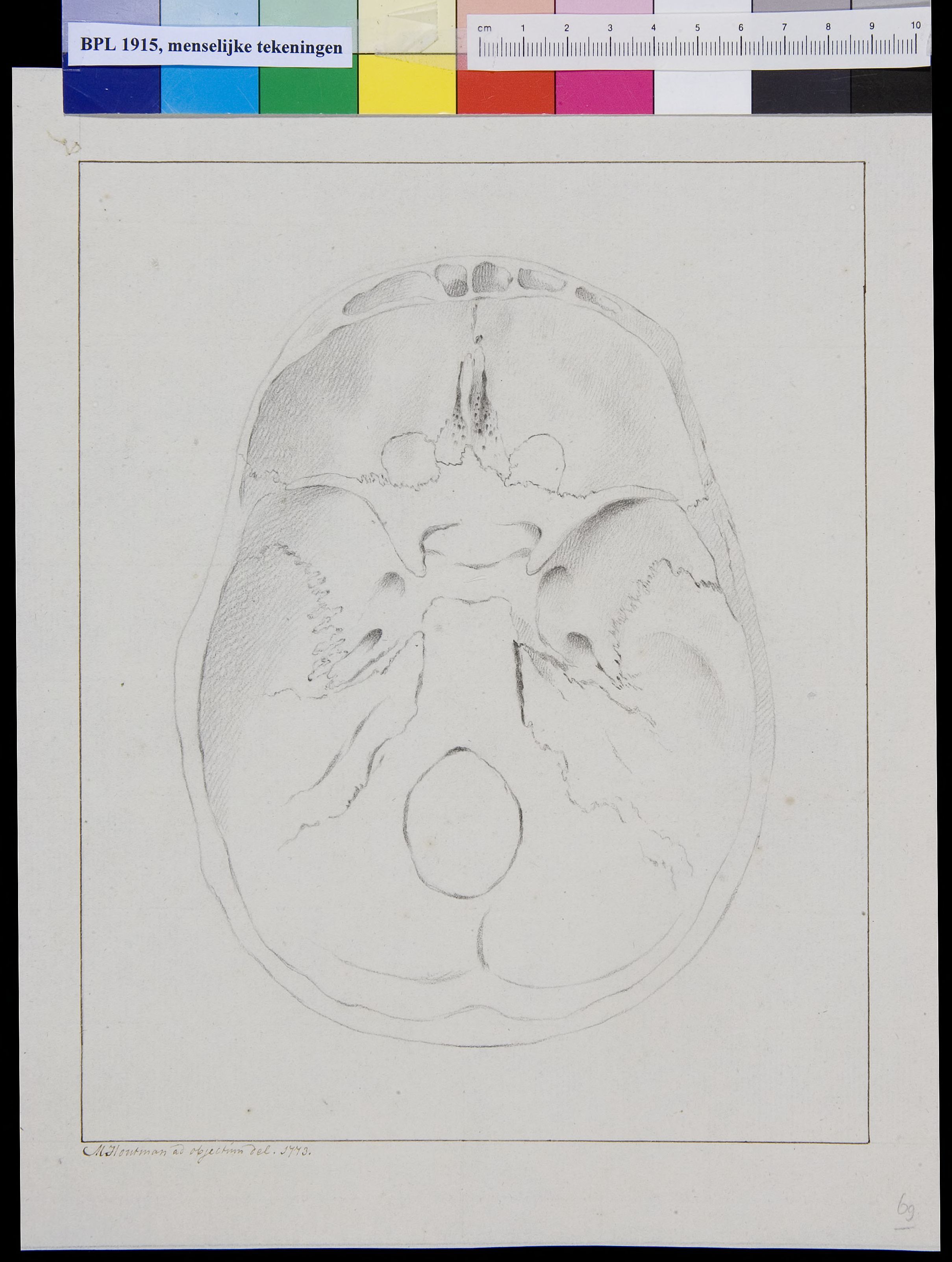 Skull