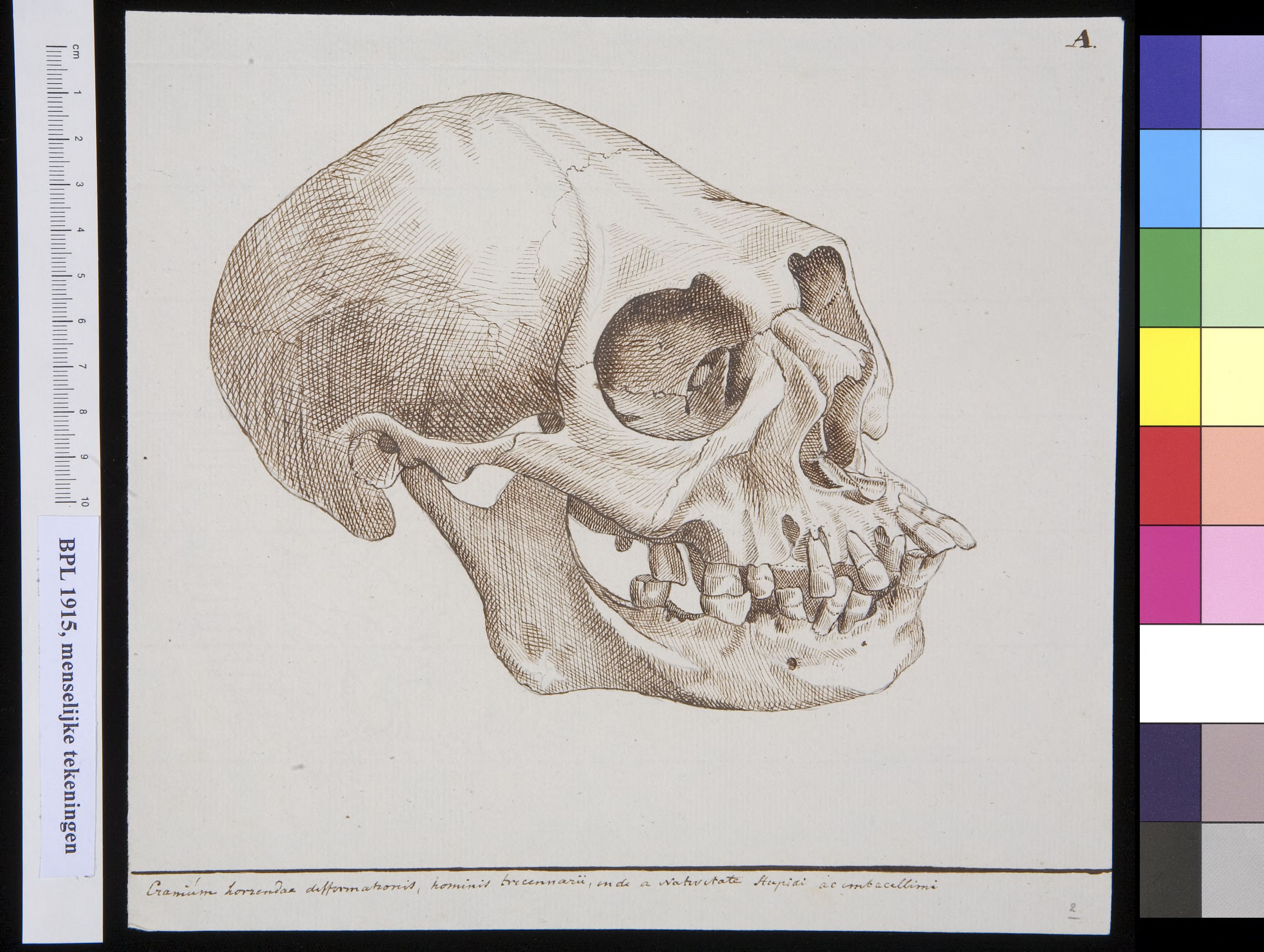 Skull