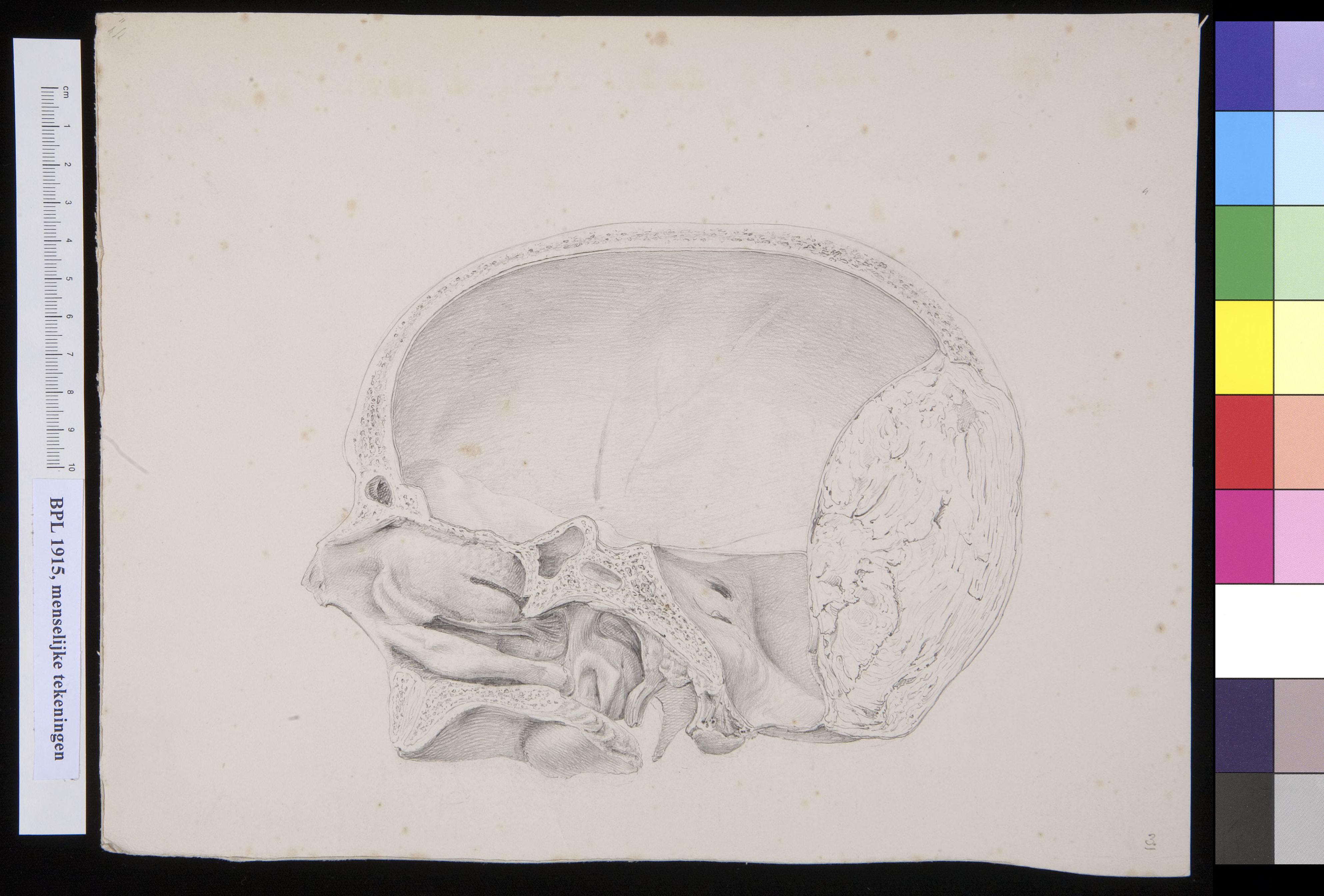 Skull